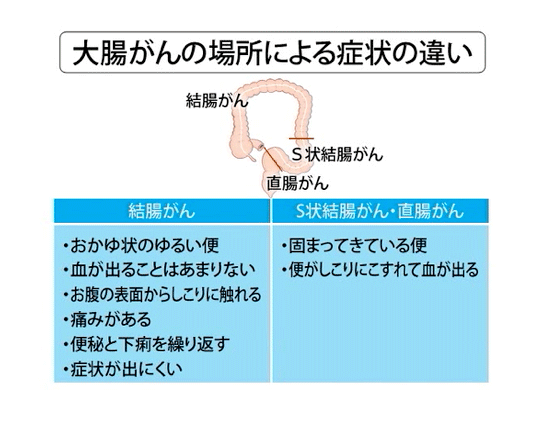 咰̏ꏊɂǏ̈Ⴂ