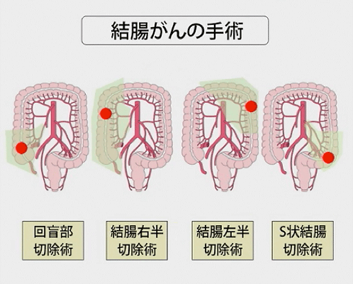 10. 麻酔の合併症
